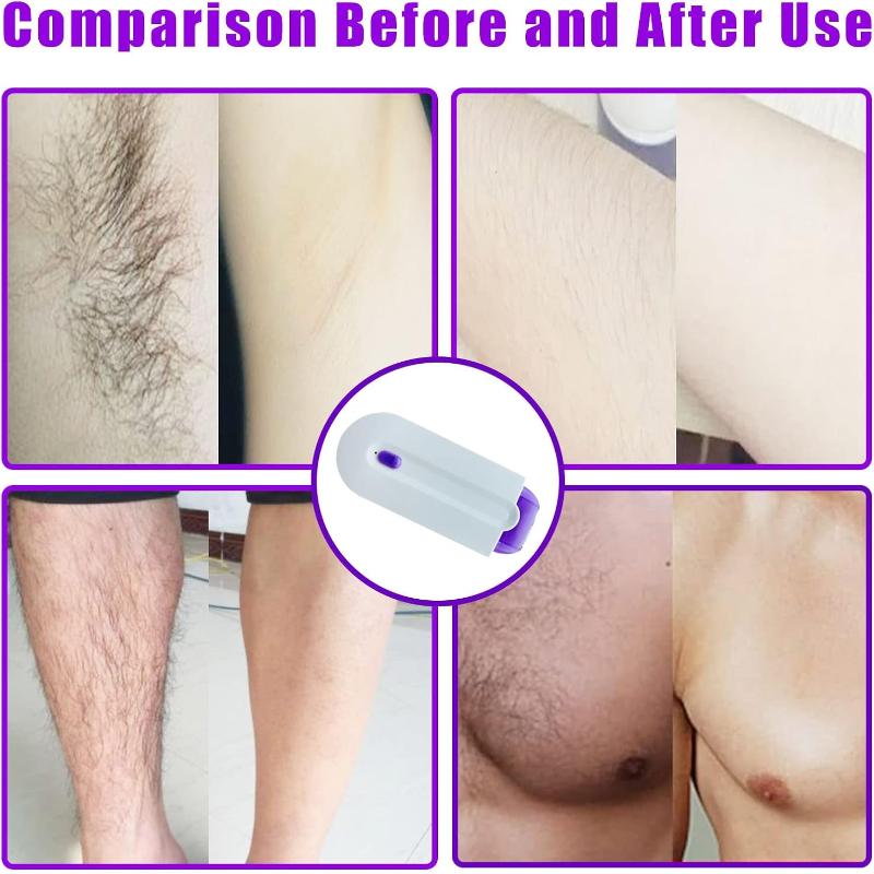 Portable Painless Hair Removal Tool