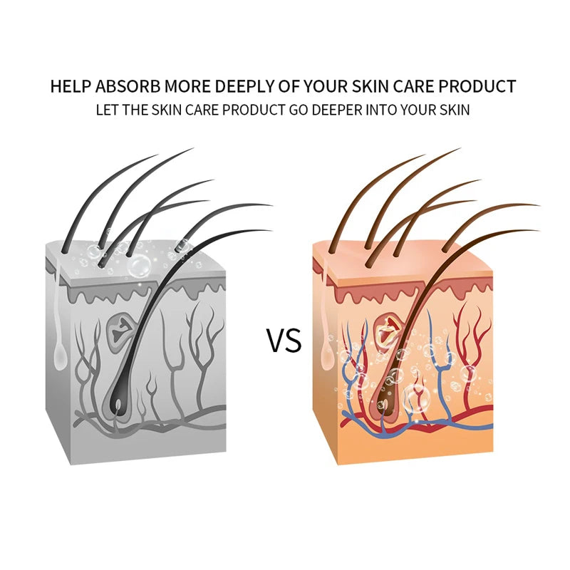 Mesotherapy Electroporation RF Face Lifting Device