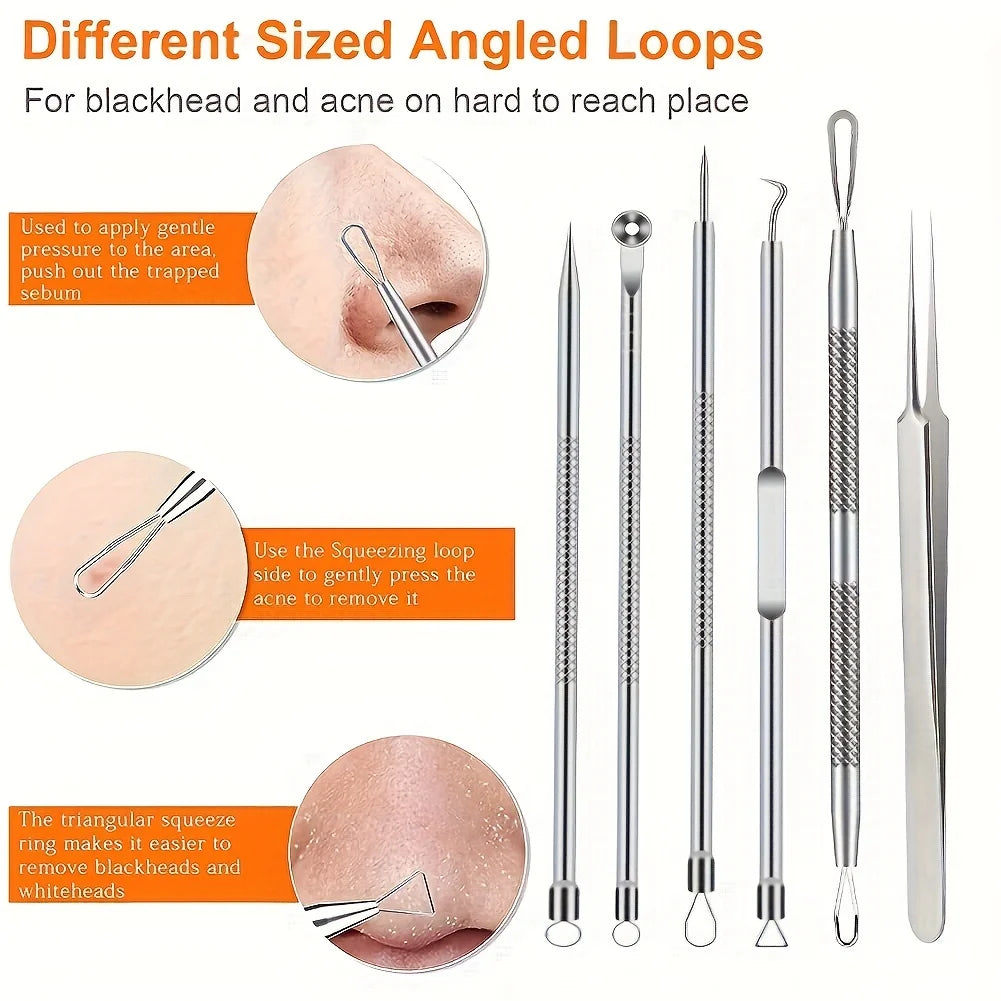 6-Pack Stainless Steel Acne Blackhead Removal Tools